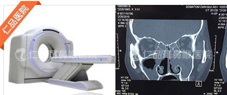 鼻部CT及检查图片