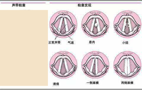 声带息肉怎么用中医治疗？